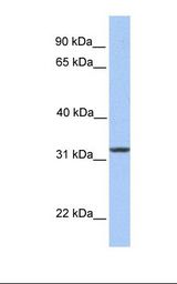 Jurkat cell lysate. Antibody concentration: 1.0 ug/ml. Gel concentration: 12%.