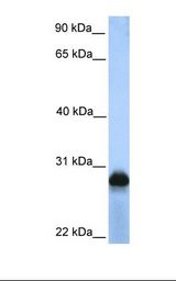 HepG2 cell lysate. Antibody concentration: 1.0 ug/ml. Gel concentration: 12%.