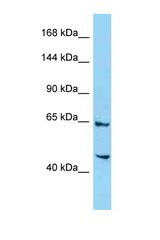 4732471D19Rik antibody LS-C146429 Western blot of Mouse Liver lysate. Antibody concentration 1 ug/ml.