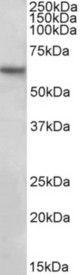 SLC1A3 antibody (2 ug/ml) staining of Human Hippocampus lysate (35 ug protein in RIPA buffer). Primary incubation was 1 hour. Detected by chemiluminescence.
