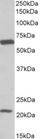 SLC1A3 antibody (0.1 ug/ml) staining of Human Frontal Cortex lysate (35 ug protein in RIPA buffer). Primary incubation was 1 hour. Detected by chemiluminescence.