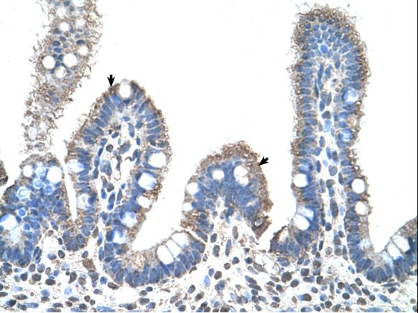 SLC22A1 antibody LS-C31871 was used in IHC to stain formalin-fixed, paraffin-embedded human intestine.