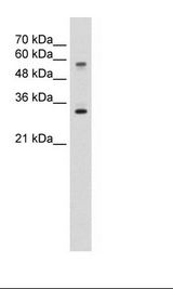 HepG2 Cell Lysate