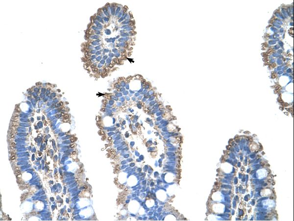 SLC22A1 antibody LS-C31870 was used in IHC to stain formalin-fixed, paraffin-embedded human intestine.