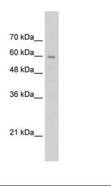 Jurkat Cell Lysate