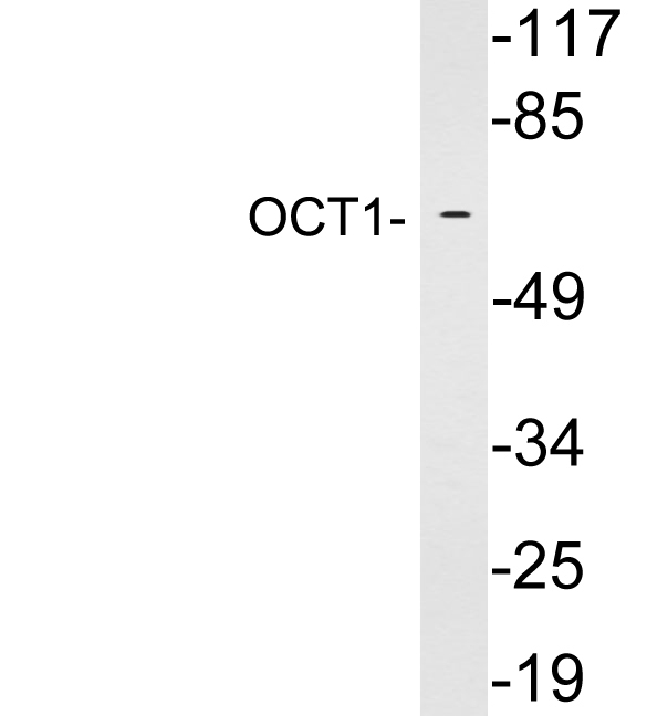 Western blot of extracts from HepG2 cells, using OCT1 antibody.