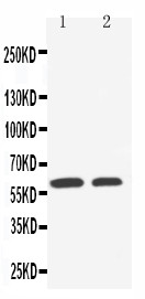 WB of SLC22A1 / OCT1 antibody. Lane 1: HELA Cell Lysate. Lane 2: A549 Cell Lysate.