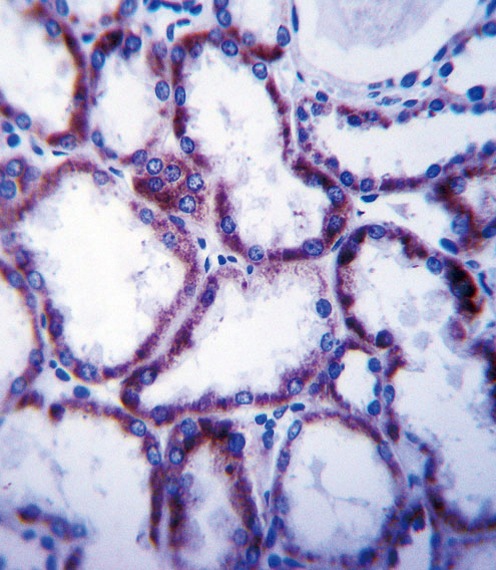 SLC22A1 Antibody immunohistochemistry of formalin-fixed and paraffin-embedded human kidney tissue followed by peroxidase-conjugated secondary antibody and DAB staining.