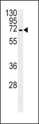 SLC22A1 Antibody western blot of HepG2 cell line lysates (35 ug/lane). The SLC22A1 antibody detected the SLC22A1 protein (arrow).