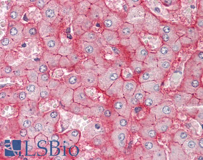 Anti-SLC22A1 / OCT1 antibody IHC staining of human liver. Immunohistochemistry of formalin-fixed, paraffin-embedded tissue after heat-induced antigen retrieval.