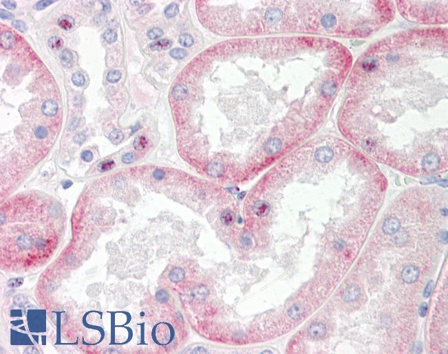 Anti-SLC22A6 / NKT antibody IHC of human kidney. Immunohistochemistry of formalin-fixed, paraffin-embedded tissue after heat-induced antigen retrieval. Antibody LS-B8083 dilution 5-10 ug/ml.
