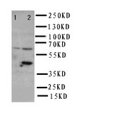 WB of SLC22A6 / OAT1 antibody. Lane 1: HT1080 Cell Lysate. Lane 2: HELA Cell Lysate.