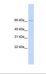 Placenta lysate. Antibody concentration: 1.0 ug/ml. Gel concentration: 12%.