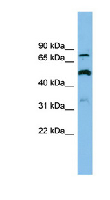 SLC26A1 antibody LS-C116252 Western blot of OVCAR-3 cell lysate.