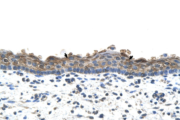 SLC26A1 antibody LS-C40441 IHC of formalin-fixed, paraffin-embedded human Skin. Positive label: Squamous epithelial cells indicated with arrows. Antibody concentration 4-8 ug/ml. Magnification 400X.