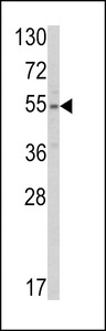 Western blot of SLC38A3 Antibody in HepG2 cell line lysates (35 ug/lane). SLC38A3 (arrow) was detected using the purified antibody.