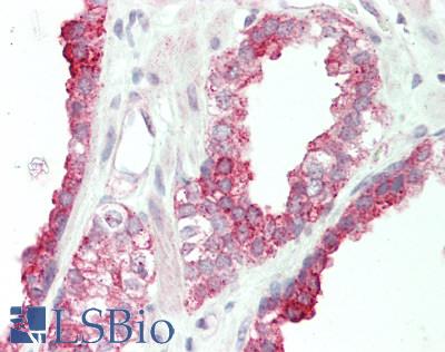 Human Prostate: Formalin-Fixed, Paraffin-Embedded (FFPE)