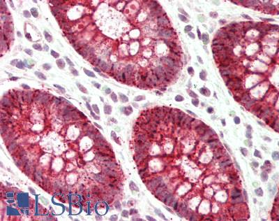 Human Colon: Formalin-Fixed, Paraffin-Embedded (FFPE)