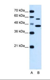Lane A: Marker. Lane B: HepG2 cell lysate. Antibody concentration: 0.5 ug/ml. Gel concentration: 12%.