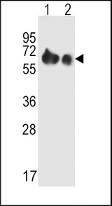 SLC3A2 Antibody western blot of A2058(lane 1),A375(lane 2) cell line lysates (35 ug/lane). The SLC3A2 antibody detected the SLC3A2 protein (arrow).