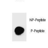 Dot blot of Phospho-PARP1-S782 Antibody Phospho-specific antibody on nitrocellulose membrane. 50ng of Phospho-peptide or Non Phospho-peptide per dot were adsorbed. Antibody working concentrations are 0.6ug per ml.