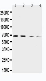 WB of SLC7A1 / ERR antibody. Lane 1: Human Placenta Tissue Lysate. Lane 2: HELA Cell Lysate. Lane 3: SKOV-3 Cell Lysate. Lane 4: HT1080 Cell Lysate.