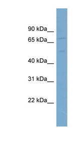 SLC7A1 antibody LS-C116244 Western blot of OVCAR-3 cell lysate.