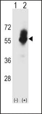 Western blot of SLC7A1 (arrow) using rabbit polyclonal SLC7A1 Antibody. 293 cell lysates (2 ug/lane) either nontransfected (Lane 1) or transiently transfected (Lane 2) with the SLC7A1 gene.
