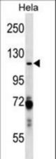 PARP1 Antibody western blot of HeLa cell line lysates (35 ug/lane). The PARP1 antibody detected the PARP1 protein (arrow).