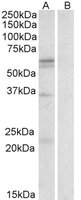 SLC7A5 antibody (0.3 ug/ml) staining of Human Spleen lysate (35 ug protein/ml in RIPA buffer) with (B) and without (A) blocking with the immunizing peptide. Primary incubation was 1 hour. Detected by chemiluminescence.