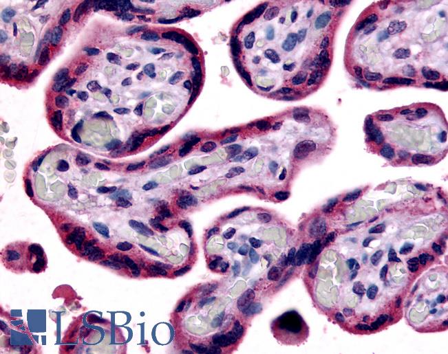 Anti-SLC7A5 antibody LS-A3096 IHC of human placenta, terminal villi. Immunohistochemistry of formalin-fixed, paraffin-embedded tissue after heat-induced antigen retrieval.