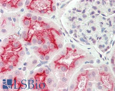 Human Kidney: Formalin-Fixed, Paraffin-Embedded (FFPE)