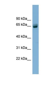 SLFN12 antibody LS-C111968 Western blot of Fetal Stomach lysate.