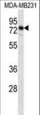 SLFN12 Antibody western blot of MDA-MB231 cell line lysates (35 ug/lane). The SLFN12 antibody detected the SLFN12 protein (arrow).