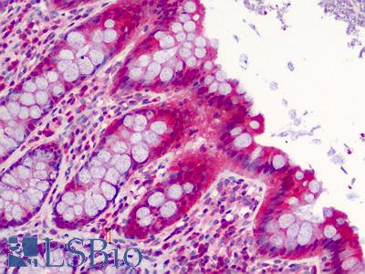 Anti-SLFN12 antibody IHC of human colon. Immunohistochemistry of formalin-fixed, paraffin-embedded tissue after heat-induced antigen retrieval. Antibody LS-B4757 concentration 2.5 ug/ml.