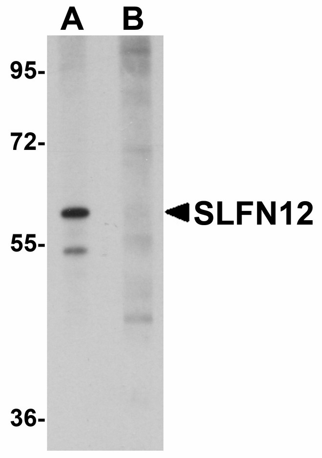 Western blot of SLFN12 in SK-N-SH cell lysate with SLFN12 antibody at 1 ug/ml in (A) the absence and (B) the presence of blocking peptide.