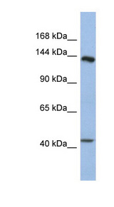SLIT1 antibody LS-C112250 Western blot of Fetal Stomach lysate.