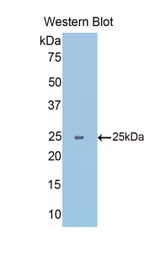 Western blot of recombinant SLIT1 / SLIT-1.