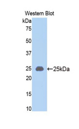 Western blot of recombinant SLIT1 / SLIT-1.