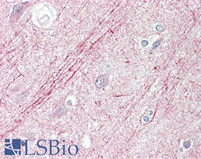 Anti-SLIT1 / SLIT-1 antibody IHC staining of human brain, cortex. Immunohistochemistry of formalin-fixed, paraffin-embedded tissue after heat-induced antigen retrieval.