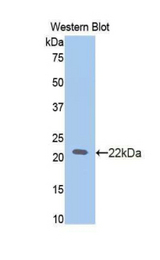 Western blot of recombinant SLIT2 / SLIT-2.