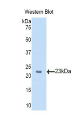 Western blot of recombinant SLIT2 / SLIT-2.