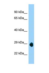 LOC632209 antibody LS-C146333 Western blot of Mouse Brain lysate. Antibody concentration 1 ug/ml.