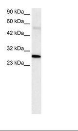 Jurkat Cell Lysate