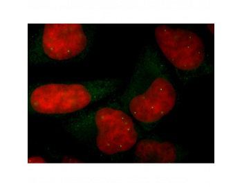 Immunocytochemistry of SMN / SMA antibody LS-C82216.