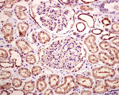 IHC of paraffin-embedded human kidney tissue using anti-SMN antibody.