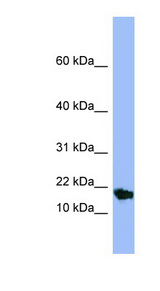 SMR3A antibody LS-C107565 Western blot of Fetal Small Intestine lysate.