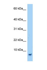 SMR3B antibody LS-C146199 Western blot of 293T Cell lysate. Antibody concentration 1 ug/ml.