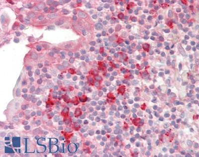 Human Tonsil: Formalin-Fixed, Paraffin-Embedded (FFPE)