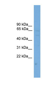 SOAT1 / STAT antibody LS-C117172 Western blot of HeLa lysate.